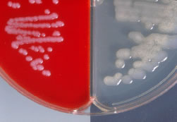 Esporos de Bacillus anthracis