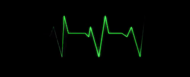 Eletrocardiograma