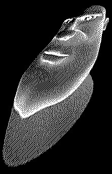 Sorriso de Gesso
