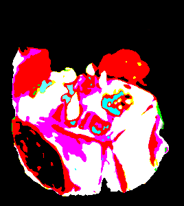 A MESA