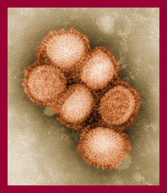H1N1