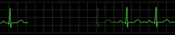 Eletrocardiograma
