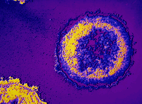 HIV