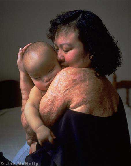Kim Phuc