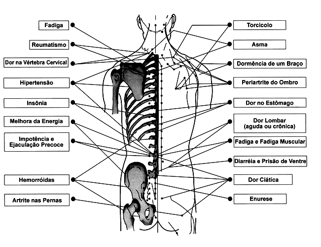 Acupuntura – Coluna Vertebral
